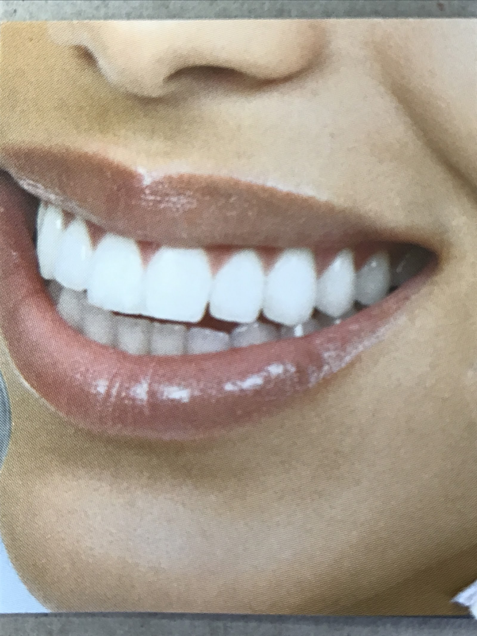 Close-up of a bright smile